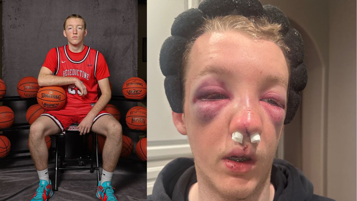 Chandler, Arizona Native and Benedictine University Basketball Star, Dylan Alvidrez,18, Suffers Traumatic Facial Injuries After Devastating Fall on the Court