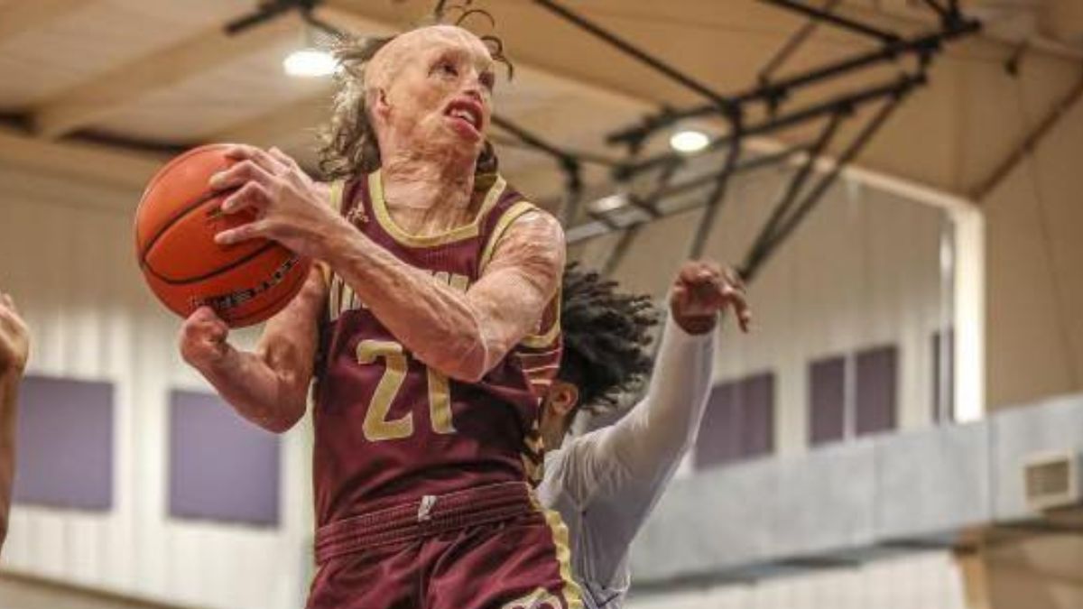 Burned Over 84% of His Body at 17 Months, Tarkington High School Student-Athlete, Dylan Mills,18, Defies All Odds to Play Basketball and Baseball