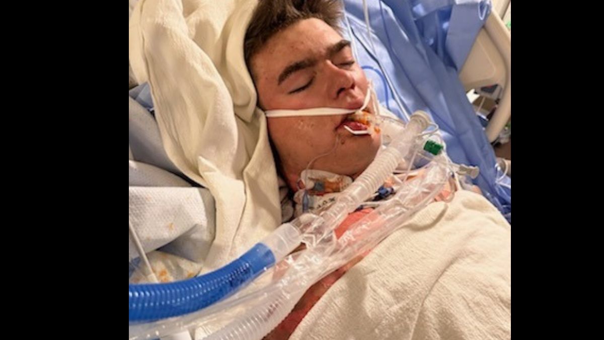 17-Year-Old Cedar City, Utah Native and Canyon View High School Football Standout, Elyn Brown Severely Burned in Life-Threatening Fire, Community Rallies in Support