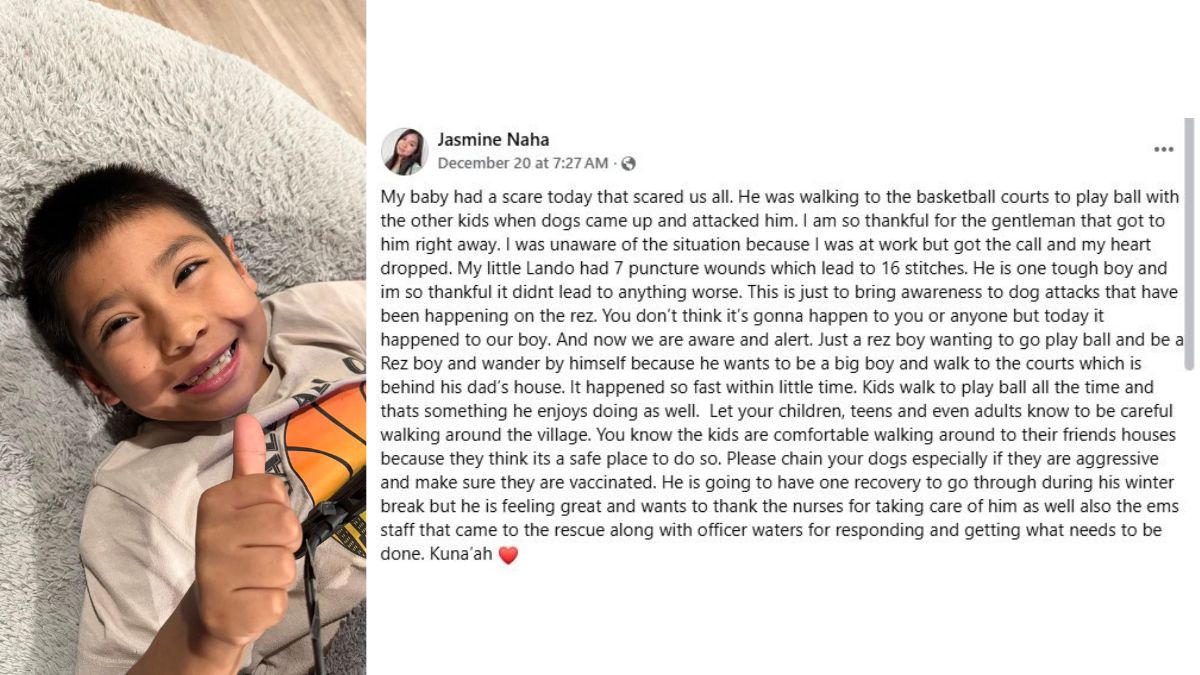 Dog Attack in Polacca, Arizona Leaves Young Boy with 16 Stitches While Walking to Basketball Courts, Family Issues Plea: Please Chain Your Dogs