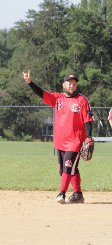 Andrew Bogert’s Face Severely Injured and His Right Eye Swollen Shut After Being Kneed in the Face Sliding Into Home Plate During a Softball Game in Colebrookdale, PA